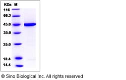 Sino Biological Recombinant Human Pleckstrin Protein (His Tag), Quantity: