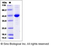 Sino Biological Human CKB / Creatine kinase B type Protein (His Tag) 50ug,