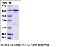 Sino Biological Recombinant Human BCCIP Protein (His & GST Tag), Quantity: