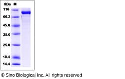 Sino Biological Human Optineurin / OPTN Protein (His & GST Tag) 100ug,