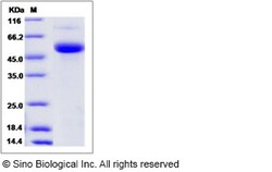Sino Biological Recombinant Human CD177 Protein (His Tag), HPLC-verified,