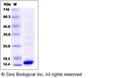 Sino Biological Recombinant Human PAX8 Protein (His Tag), Quantity: Each