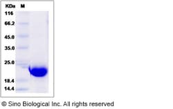 Sino Biological Recombinant Human Cofilin Protein (His Tag), Quantity: