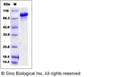 Sino Biological Recombinant Human USP30 Protein (SUMO Tag), Quantity: Each