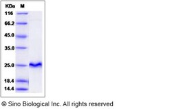 Sino Biological Recombinant Human CRIP2 Protein, Quantity: Each of 1