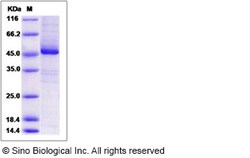 Sino Biological Human EIF3K Protein (His & GST Tag) 100ug, Quantity: Each