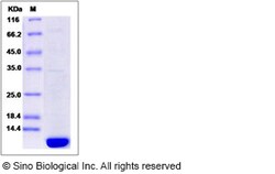 Sino Biological Recombinant Human ACBD7 Protein (His Tag), Quantity: Each