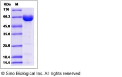 Sino Biological Recombinant Human 15 Lipoxygenase 2 Protein, Quantity: