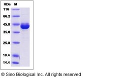Sino Biological Recombinant Human GCAP1 Protein (His & GST Tag), Quantity: