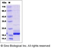 Sino Biological Recombinant Human GCAP1 Protein, Quantity: Each of 1