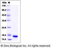 Sino Biological Recombinant Human GCSH Protein (His Tag), Quantity: Each