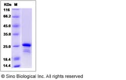 Sino Biological Recombinant Human CBFB Protein (His Tag), Quantity: Each