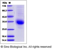 Sino Biological Human CGB5 Protein (His Tag) 100ug, Quantity: Each of 1
