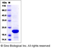 Sino Biological Recombinant Human XTP3TPA Protein (His Tag), Quantity: