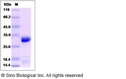 Sino Biological Recombinant Human EEF1B2 Protein (His Tag), Quantity: Each