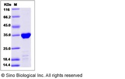 Sino Biological Recombinant Human TPM1 Protein (His Tag), Quantity: Each