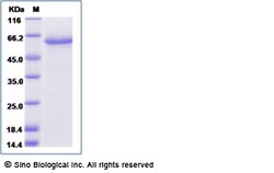 Sino Biological Recombinant Human NOTCH2NL Protein (mFc Tag), Quantity: