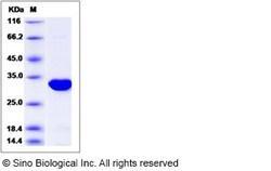Sino Biological Human MRTO4 / MRT4 Protein (His Tag) 100ug, Quantity: Each