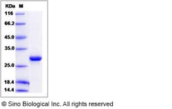 Sino Biological Human ETHE1 / HSCO Protein (His Tag) 100ug, Quantity: Each