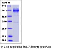 Sino Biological Recombinant Human Syntaxin 7 Protein (mFc Tag), Quantity:
