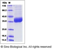 Sino Biological Recombinant Human PPT1 Protein (His Tag), Quantity: Each