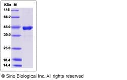 Sino Biological Recombinant Human IL-13 Protein (hFc Tag), HPLC-verified,