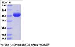 Sino Biological Recombinant Human B3GNT1 Protein (His Tag), Quantity: Each