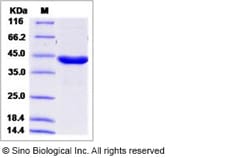 Sino Biological Human ACAA1 / PTHIO Protein (His Tag) 100ug, Quantity: