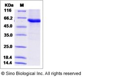 Sino Biological Recombinant Human EPHX2 Protein (His Tag), Quantity: Each
