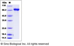 Sino Biological Recombinant Human DPYS Protein (His & GST Tag), Quantity: