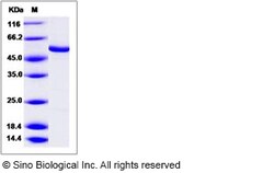 Sino Biological Recombinant Human DPYS Protein, Quantity: Each of 1
