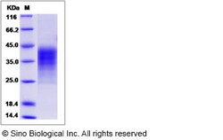 Sino Biological Recombinant Human LIF Protein (His Tag), Quantity: Each
