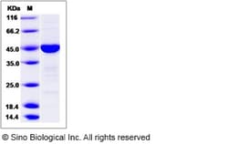 Sino Biological Recombinant Human CHN1 Protein, Quantity: Each of 1