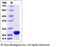 Sino Biological Human CETN2 / Centrin 2 Protein (His Tag) 100ug, Quantity:
