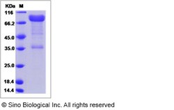 Sino Biological Recombinant Human Ribophorin II Protein (hFc Tag), Quantity: