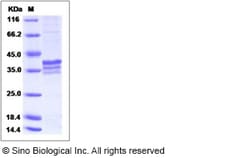 Sino Biological Recombinant Human MRPL44 Protein (His Tag), Quantity: Each