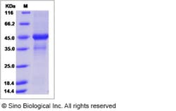 Sino Biological Human ERp44 / TXNDC4 Protein (His Tag) 100ug, Quantity: