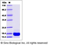 Sino Biological Recombinant Human PFDN1 Protein (His Tag), Quantity: Each