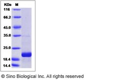 Sino Biological Recombinant Human eIF5A Protein (His Tag), Quantity: Each