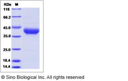 Sino Biological Recombinant Human CD52 Protein (hFc Tag), Quantity: Each