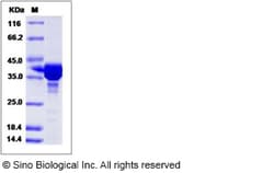 Sino Biological Human CEP57 / MVA2 Protein (GST Tag) 100ug, Quantity: Each