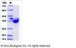 Sino Biological Human PRPS2 Protein (His Tag) 50ug, Quantity: Each of 1