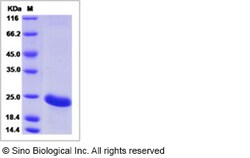 Sino Biological Recombinant Human MSRB3 Protein (His Tag), Quantity: Each
