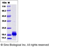 Sino Biological Recombinant Human RBP7 Protein (His Tag), Quantity: Each
