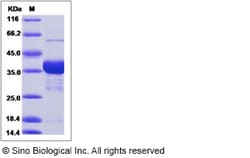 Sino Biological Recombinant Human AKR1C4 Protein (His Tag), Quantity: Each