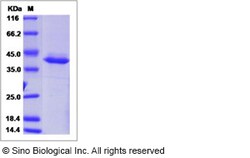 Sino Biological Recombinant Human DEFB127 Protein (hFc Tag), Quantity: