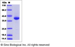 Sino Biological Recombinant Human LY6D Protein (mFc Tag), Quantity: Each