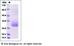 Sino Biological Human LACRT Protein (His Tag) 100ug, Quantity: Each of