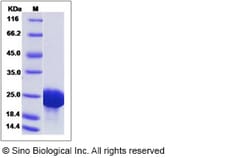 Sino Biological Recombinant Human Olfactory Marker Protein Protein (His