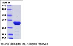 Sino Biological Recombinant Human DCUN1D2 Protein (His Tag), HPLC-verified,